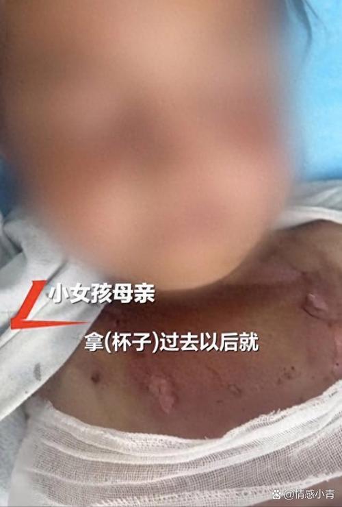 女童被蜜蜂蛰伤致死